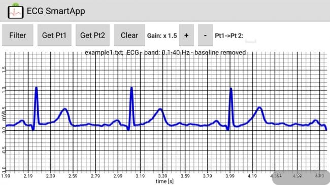 Чем открыть файл ecg